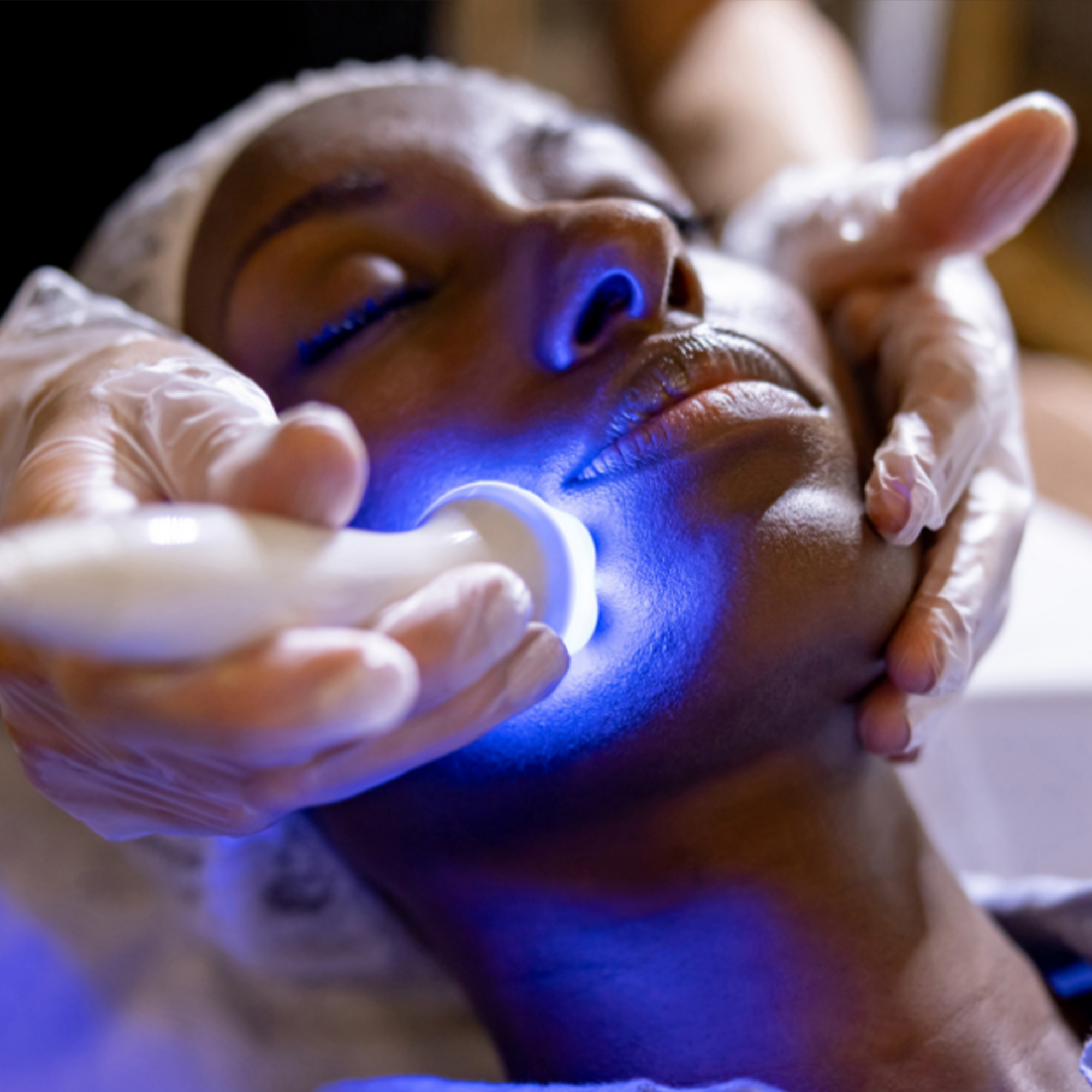 Laser / Aesthetic Treatment